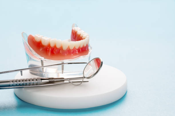Full Mouth Reconstruction in Social Circle, GA